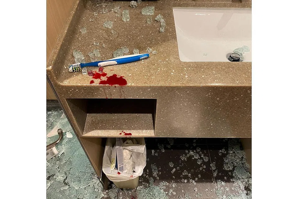 SERPIHAN KACA BERDERAI: Menurut Cik Suziyana, dengan tiba-tiba pintu kaca bilik air bilik Siloso Beach Resort itu jatuh dan pecah berkecai (atas) menyebabkan beliau cedera di lengan, tangan, dada dan kulit kepala. - Foto BH oleh KHALID BABA, ihsan SUZIYANA HAMID