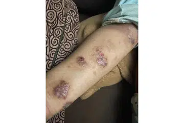 Aduh, sakitnya!