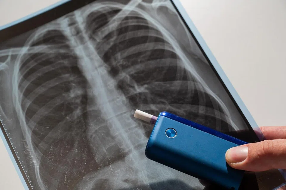 Kesihatan, bahaya wap vape, amaran doktor 