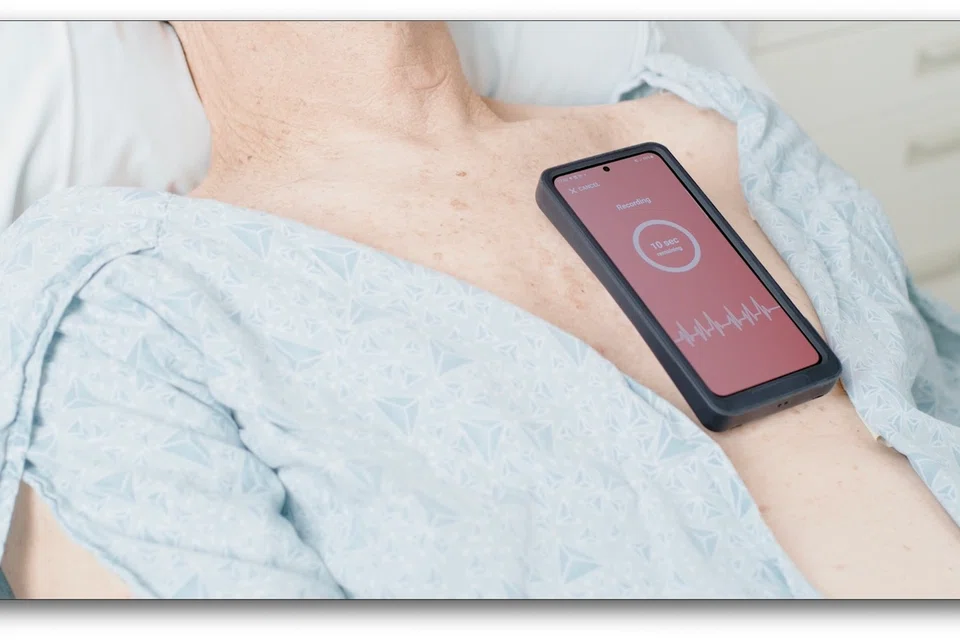 Peranti penderiaan tekanan jantung dan paru-paru bukan invasif, iaitu peranti Acorai, berpotensi mengubah cara pesakit kegagalan jantung dipantau dan dirawat.