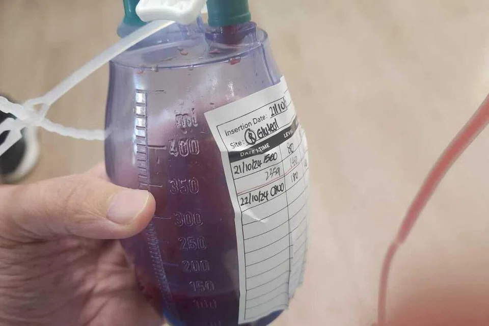 Encik Faisal Sulaiman perlu membawa botol sebesar 400 mililiter (ml) yang dihubungkan pada tubuhnya selepas pembedahan bagi menampung darah dari luka pembedahan, dan mempunyai tiga botol tambahan untuk digunakan apabila botol tersebut penuh. Botol yang dihubungkan kepada pinggulnya itu kemudian ditanggalkan kira-kira dua hingga tiga bulan selepas pembedahan.