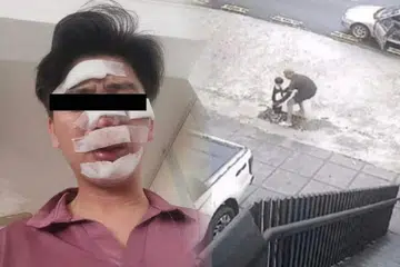 SELAMATKAN ANAK: Peniaga yang hanya dikenali sebagai ‘Lin’ (kiri) cedera setelah mengejar kereta penculik demi menyelamatkan anaknya. 