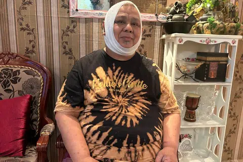 Encik Mohamad Hashim Arshad mengalami kecederaan serius – termasuk memerlukan lebih 10 jahitan di dahi dan bahagian belakang kepala, lebam di lengan kiri serta luka di lutut kiri.