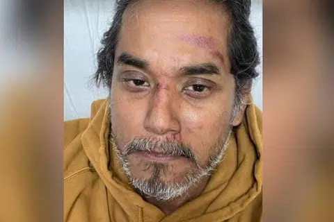 Encik Khairy mengalami kecederaan ringan dan menerima rawatan di hospital berdekatan.