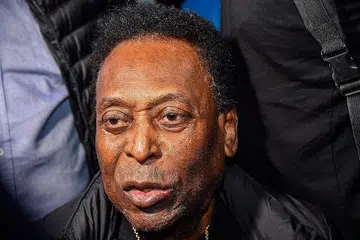 PERMATA BOLA SEPAK DUNIA: Pele, 80 tahun, ditempatkan sementara di Unit Jagaan Rapi di hospital di Sao Paolo dilihat berada di katil hospital dengan mengenakan jaket hitam, sedar dan tersenyum. - Foto AFP