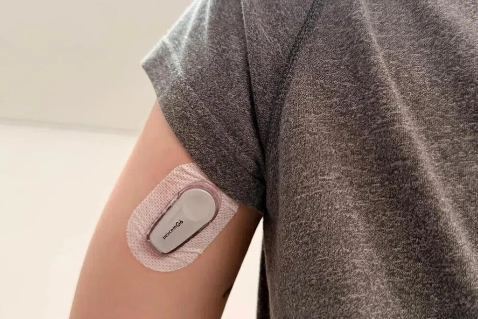 Ng Zhuang Shu, CGM, Dexcom G6