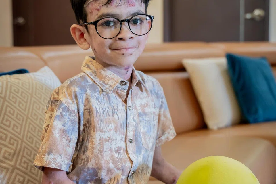 Muhammad Raed Mohammad Shanwaz, menghidapi penyakit kulit jarang berlaku, Epidermolisis Bulosa (EB), sejak lahir. Penyakit itu membuat kulit Raed halus dan rapuh, seperti sayap kupu-kupu.