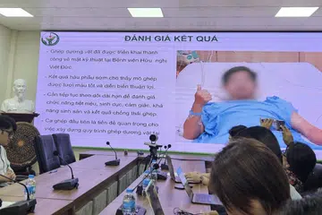 Doktor Hospital Persahabatan Viet Duc di Hanoi mengadakan sidang media pada 29 Julai bagi mengumumkan kejayaan pemindahan zakar pertama di Vietnam menggunakan organ daripada penderma yang disahkan mati otak. Prosedur bersejarah itu berjaya memulihkan organ kepada seorang lelaki berusia 43 tahun yang kehilangan sebahagian zakarnya akibat penyakit, sekali gus membuka lembaran baharu dalam program pemindahan organ dan pembedahan rekonstruktif negara itu.