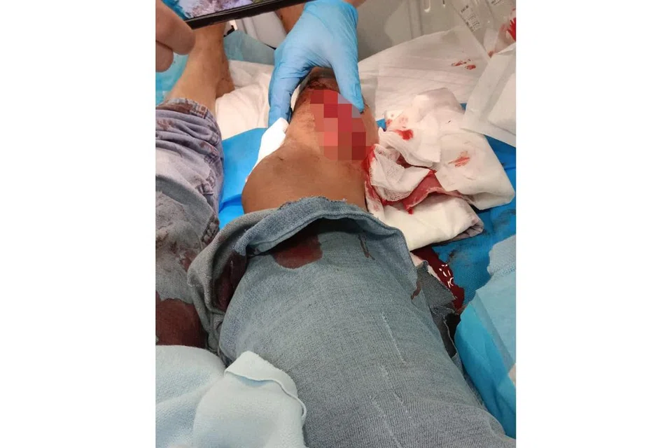 SERANGAN BABI HUTAN: Serangan itu menyebabkan Cik Durga Devi mengalami pelbagai luka dan luka di betis kanan, punggung dan lengannya. - Foto ihsan SRI DEVI