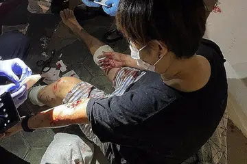 SERANGAN LIAR: Wanita yang diserang babi hutan di Punggol Sabtu malam lalu dirawat oleh paramedik SCDF. - Foto WANBAO
