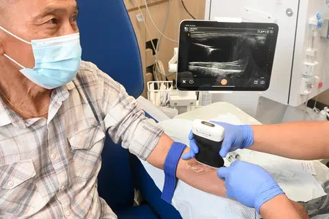 Pesakit buah pinggang, Encik Job Loei, 60 tahun, menjalani prosedur kanulasi menggunakan peranti berpandukan ultrasound, satu kemajuan teknologi yang telah diguna pakai oleh Yayasan Buah Pinggang Kebangsaan (NKF) untuk meningkatkan perkhidmatannya.