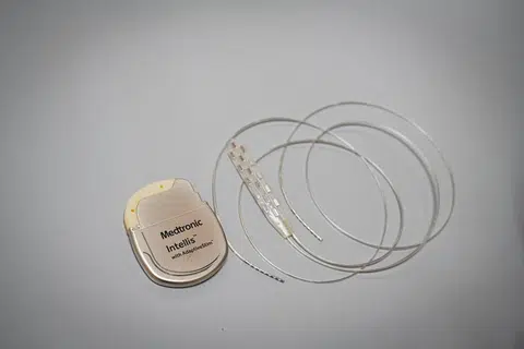 BANTU PESAKIT LUMPUH: Alat elektrod (kanan) persis saiz jari kecil orang dewasa akan dibedah masuk di atas permukaan tulang belakang peserta percubaan diikuti baterinya (kiri) hasil syarikat Medtronic.