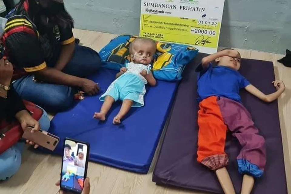 KORBAN NAHAS JALAN RAYA: Kisah Allahyarham Nor Rahil Raihan Mohd Shahrul menghidap penyakit hydrocephalus (lebihan cecair dalam otak), ginjal rosak dan pendarahan dalam perut tular dan mendapat liputan luas media sebelum ini.  