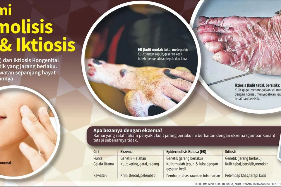 Perbandingan Epidermolisis Bulosa dan Iktiosis berbanding ekzema