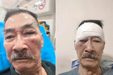 BENGKAK: Pegawai keselamatan yang hanya dikenali sebagai Abang Kwek dipercayai ditumbuk semasa menjalankan tugas di Bedok Central.