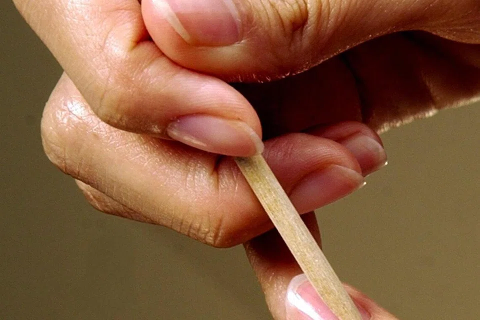 Perubahan pada kuku, seperti garis, lekukan, kerapuhan atau perubahan ketebalan secara tiba-tiba, boleh menandakan masalah kesihatan.