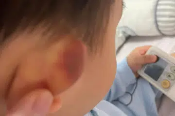 CEDERA DI PRASEKOLAH: Seorang guru prasekolah disiasat kerana didakwa menolak seorang budak lelaki berusia setahun yang cuba memanjat jeriji tingkap, menyebabkan dia terjatuh. Bapanya ternampak lebam pada telinga kanan anaknya dan beberapa calar di mukanya. 