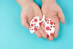 kes baru, TB, M’sia