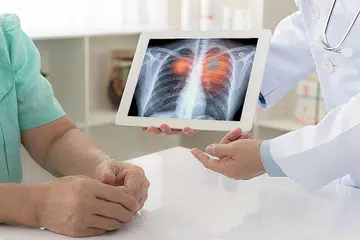 - Foto hiasan ISTOCK