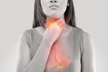 Refluks ditakrif sebagai kandungan makanan atau asid di dalam perut yang naik semula ke esofagus atau sehingga ke bahagian kerongkong. Refluks perkara normal yang boleh berlaku sekali-sekala disebabkan kelonggaran sfinkter (pencerut) di bahagian esofagus bawah.