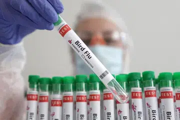 Sumber pendedahan kepada virus selesema burung itu tidak diketahui, kata WHO, walaupun kes H5N2 telah dilaporkan dalam unggas di Mexico. 