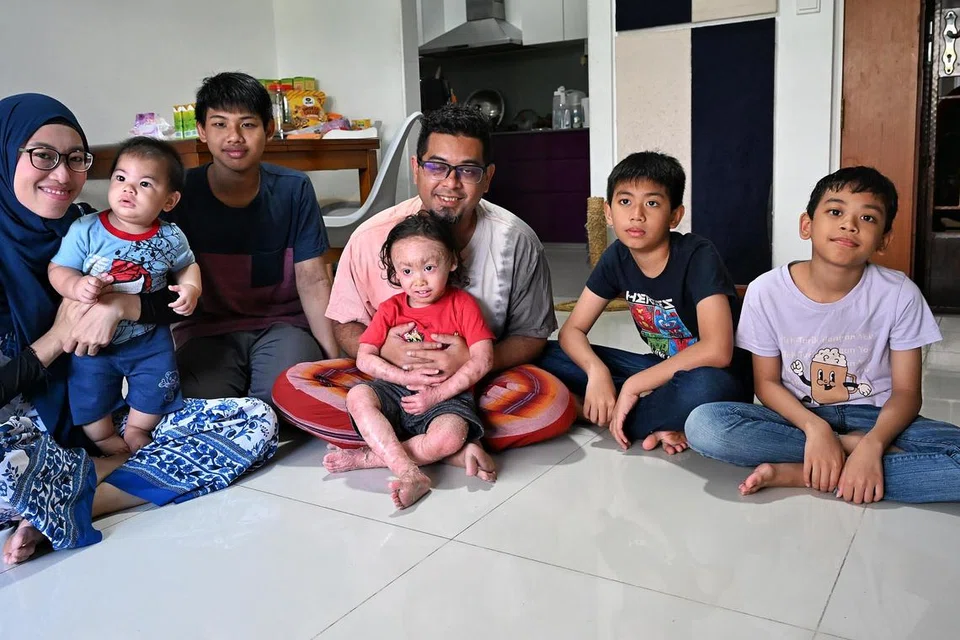 Rafif Afkari Abdul Hadi (tiga dari kanan) menghidapi penyakit kulit jarang berlaku, iktiosis kongenital. Bersamanya (dari kiri), Cik Nurdiyanah Jam Hari, Raif Aldari Abdul Hadi, Danish Nur Anaqi Abdul Hadi, Abdul Hadi Zainoordin, Abdul Khaliq Abdul Hadi dan Muhammad Khaizuran Abdul Hadi.