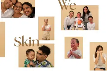 Buku foto yang diterbitkan Rare Skin Conditions Society Singapore dan Debra Singapore, pertubuhan-pertubuhan yang menyokong penyakit kulit jarang berlaku di Singapura.
