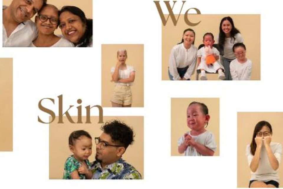 Buku foto yang diterbitkan Rare Skin Conditions Society Singapore dan Debra Singapore, pertubuhan-pertubuhan yang menyokong penyakit kulit jarang berlaku di Singapura.