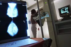 Di bawah program SG Lebih Sihat, rakyat Singapura boleh menerima subsidi penuh bagi pemeriksaan buah dada di klinik SG Lebih Sihat. 