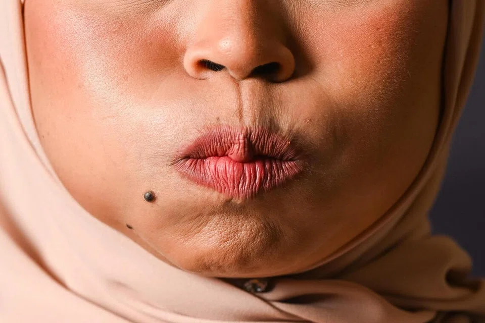 Gelembungkan bahagian pipi untuk beberapa minit sebagai sebahagian yoga muka boleh membantu mengurangkan garisan halus di wajah.