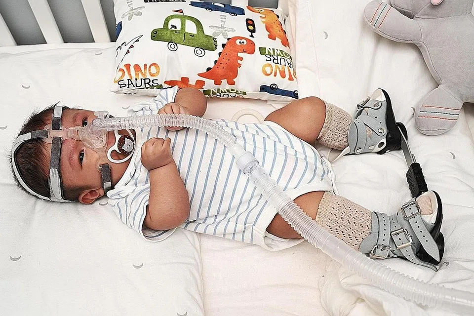 HADAPI PELBAGAI CABARAN: Muhammad Nurfattah Muhammad Nurfahmy, enam bulan, dilengkap beberapa alat bagi menetapkan posisi kakinya atas keadaan sendi-sendinya terbengkok dan melekuk serta tiub dari mesin Tekanan Saluran Udara Positif Berterusan (CPAP) bagi membantu pernafasannya. 