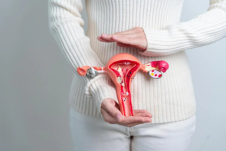 Beginilah contoh keadaan dalaman organ uterus dan ovari wanita.
