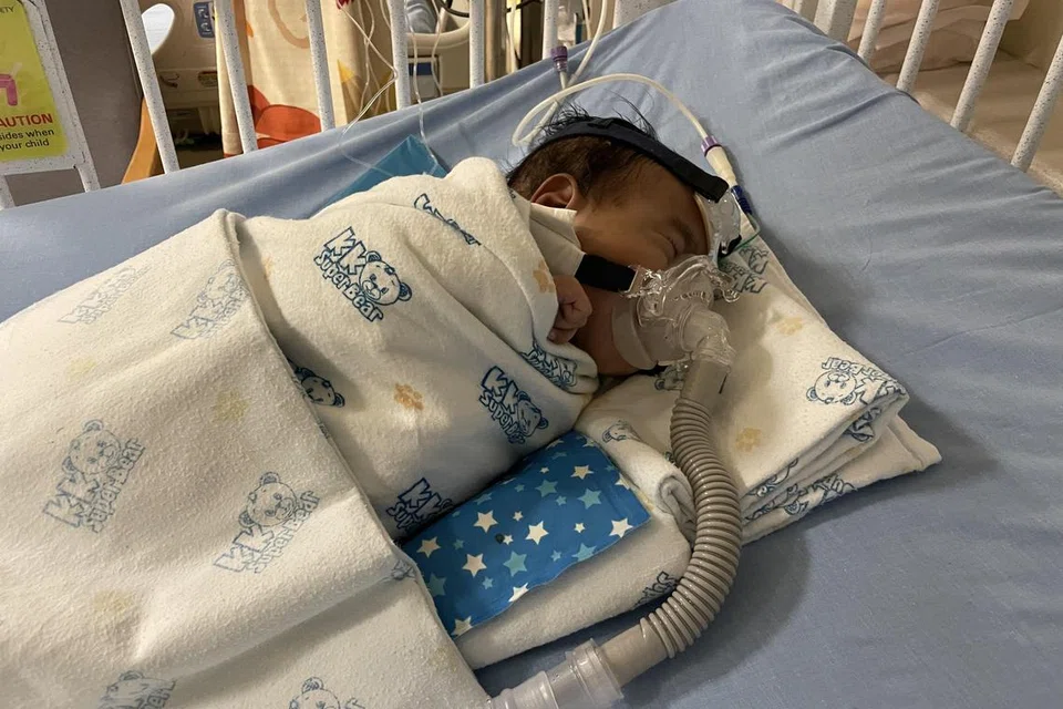 BANTUAN PERNAFASAN: Eisa Airil, dua bulan, yang lahir dengan masalah jantung kongenital, masih perlu menggunakan alat bantuan pernafasan sepanjang hari. 