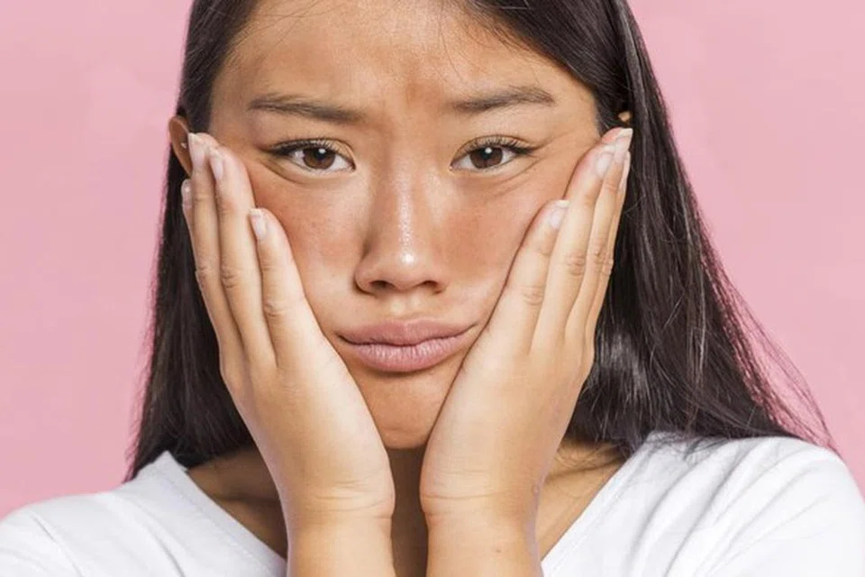 Contoh wajah pucat dan berkulit kusam.