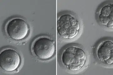 Embrio manusia yang baru disenyawakan (kiri) dan pada peringkat lapan sel (kanan) yang DNAnya telah disunting menggunakan teknologi CRISPR.