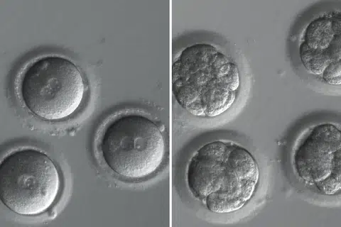 Embrio manusia yang baru disenyawakan (kiri) dan pada peringkat lapan sel (kanan) yang DNAnya telah disunting menggunakan teknologi CRISPR.