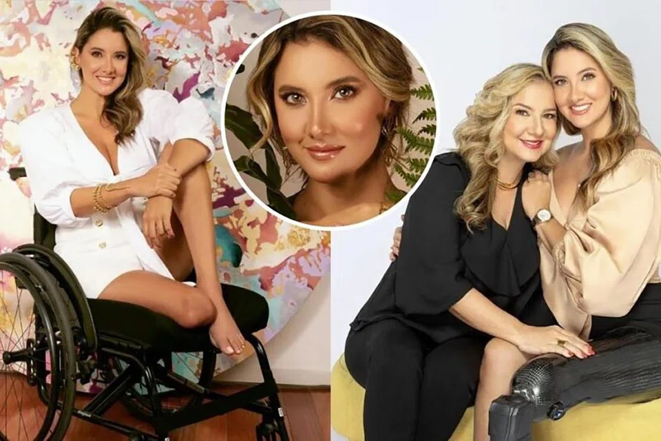 TETAP POSITIF: Kaki kiri Cik Daniella Alvarez, 32 tahun, dari Barranquilla, Colombia, yang dinobatkan sebagai Miss Colombia pada 2011 dan seterusnya mewakili negaranya di Miss Universe 2012, telah dipotong berikutan komplikasi pembedahan. 