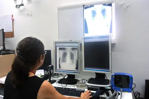 PEMERIKSAAN PERCUMA: Kementerian Kesihatan (MOH) menawarkan pemeriksaan percuma bagi mengesan penyakit batuk kering selepas kelompok seramai empat individu di unit berbeza Blok 174D Hougang Avenue 1. - Foto FAIL