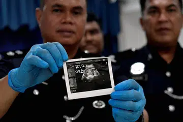 KES DISIASAT: Ketua Polis Daerah Sabak Bernam Superintendan Agus Salim Mohd Alias menunjukan imbasan ultrabunyi yang dipercayai milik mangsa dalam kejadian kes bunuh dan bakar seorang wanita berusia 21 tahun pada sidang media di Ibu Pejabat Polis Daerah Sabak Bernam pada Jumaat.
