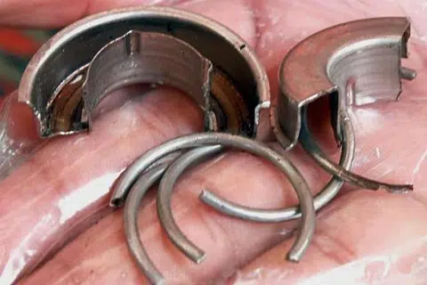 Cincin galas bebola yang dipotong dari zakar lelaki itu di Hospital Pulau Pinang. 