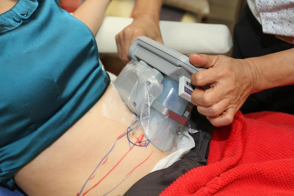 Salah satu kaedah ‘fat freeze’ seperti ‘CoolSculpting’, iaitu prosedur pembekuan lemak prosedur bukan invasif dengan meletakkan aplikator mengikut kawasan bertanda pada perut. Apabila ia dihidupkan, ia akan menyedut daging di bahagian perut ke dalam cawan khas dan menyejukkannya sehingga 4 darjah Celsius.