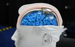 The Wimagine implant from CEA, a device seen on a replica brain which helps patients with spinal cord issues walk again is on display at the Consumer Electronics Show in Las Vegas, Nevada, Jan 7, 2024.