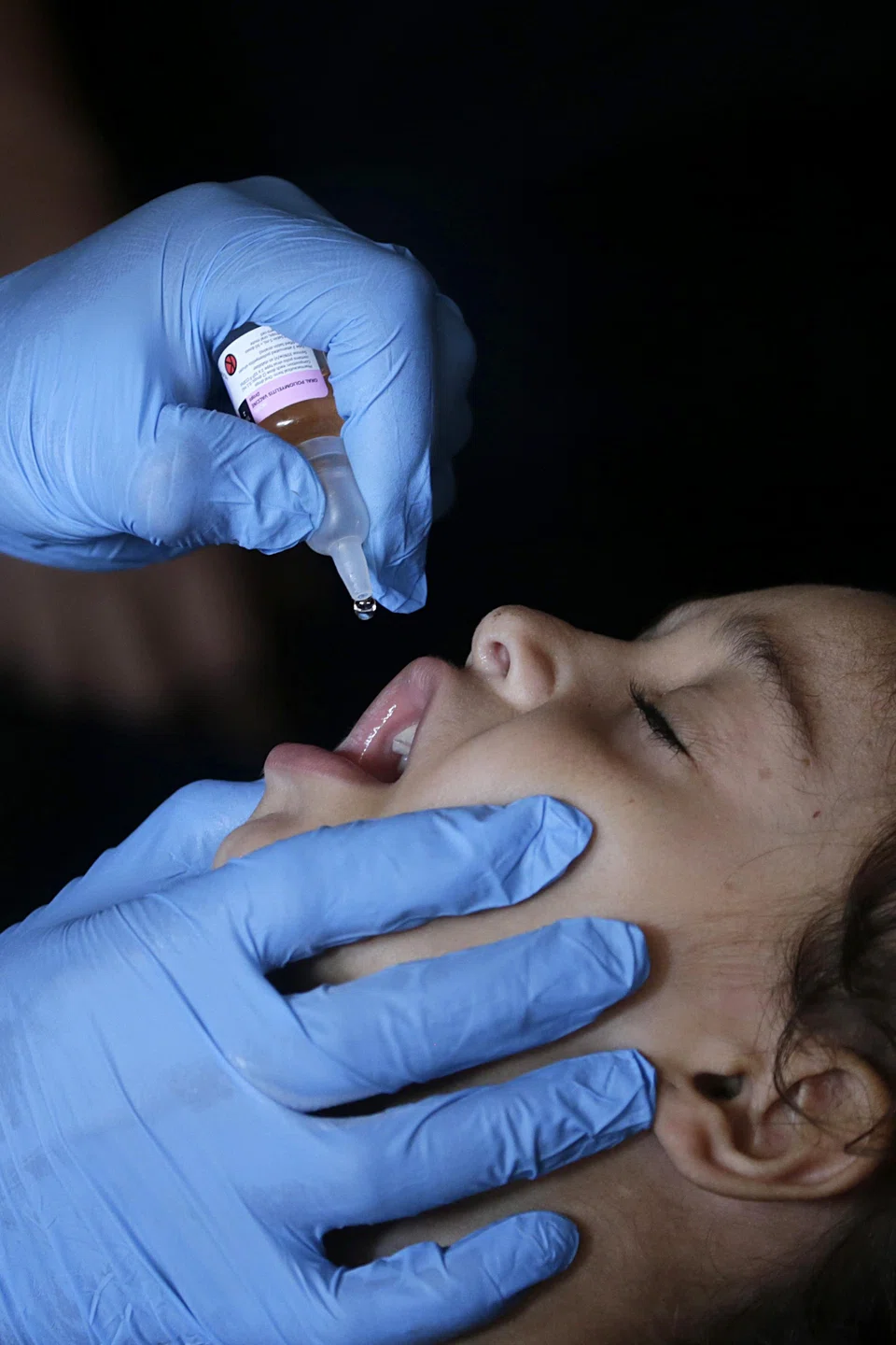 A nurse administers polio vaccine drops to a Palestinian child at a UN school in  central Gaza Strip. The WHO says it has vaccinated over 161,000 children under 10 in the central area in the first two days of its campaign, versus a projected 150,000.