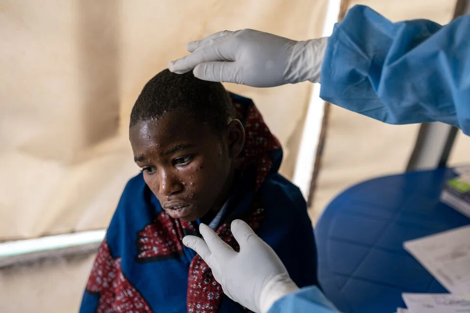 The move underpins efforts by the agency and its partners to stop chains of human-to-human mpox transmission.