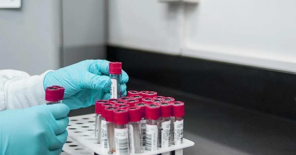 Asia-Pacific medical trend rate expected to edge downwards in 2027 – but not in Singapore: Aon