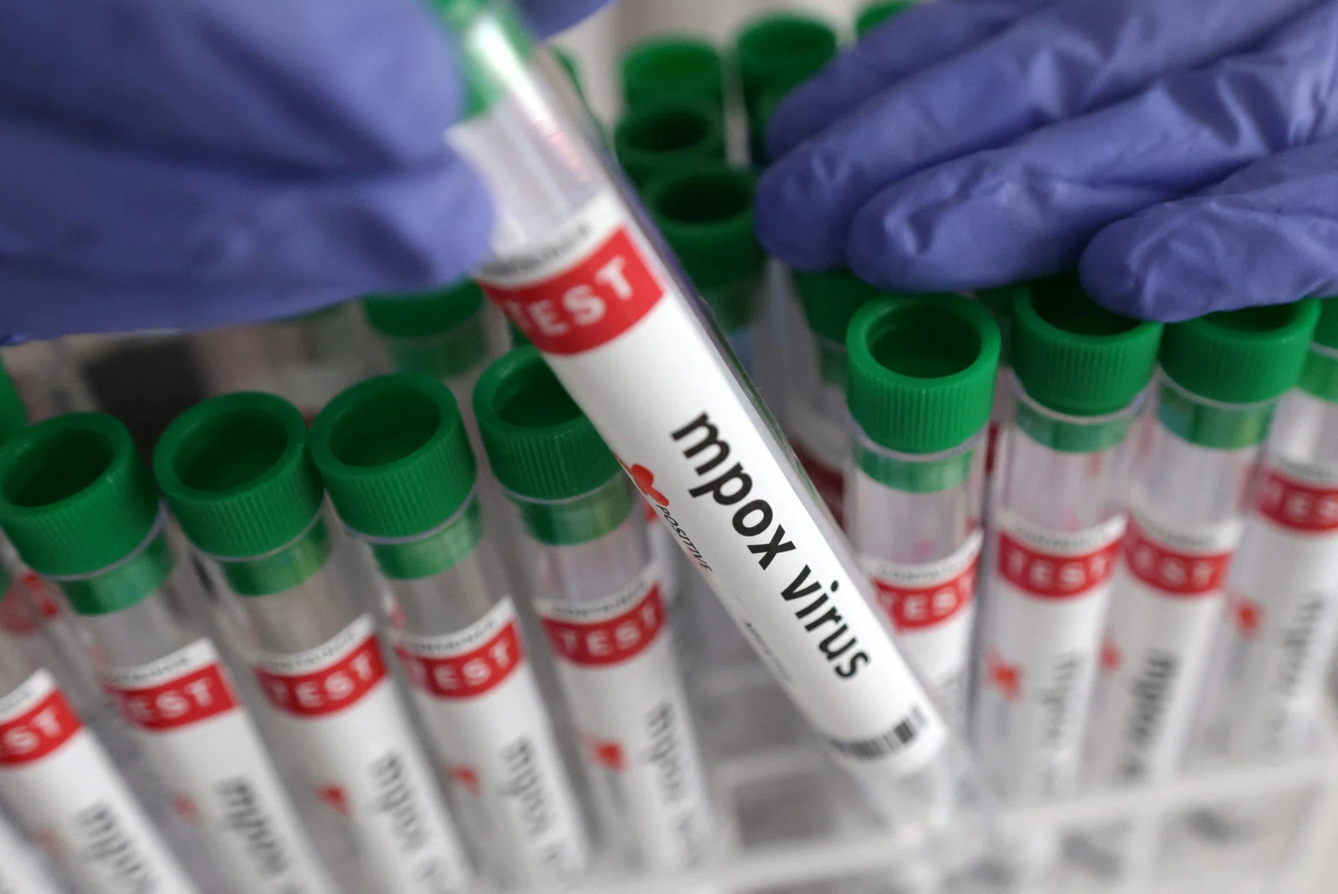 Thailand reports suspected case of new mpox strain - The Business Times