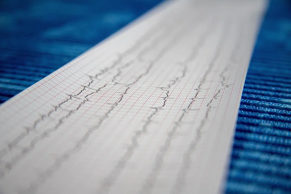 Simple cardiac tests include electrocardiograms (ECG) to check your heart's rhythm and electrical activity.