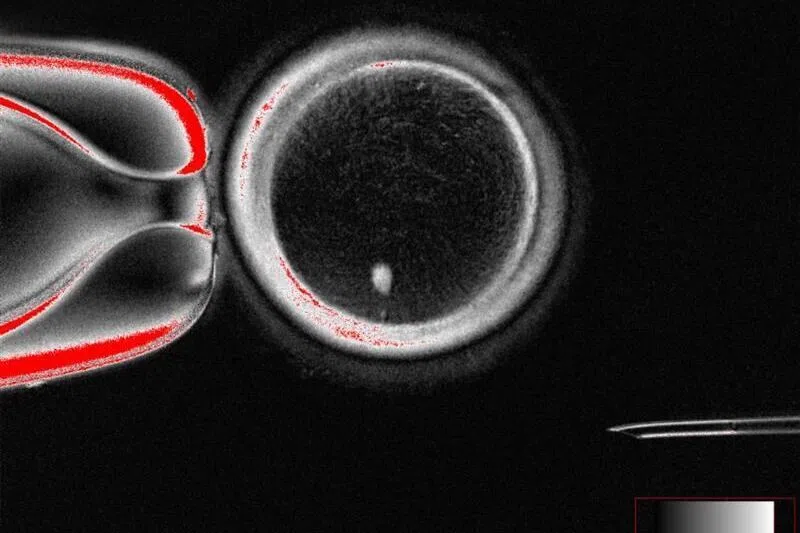 Researchers from Oregon Health & Science University say that they solved the problem of the extra set of chromosomes by inducing a process they call mitomeiosis.