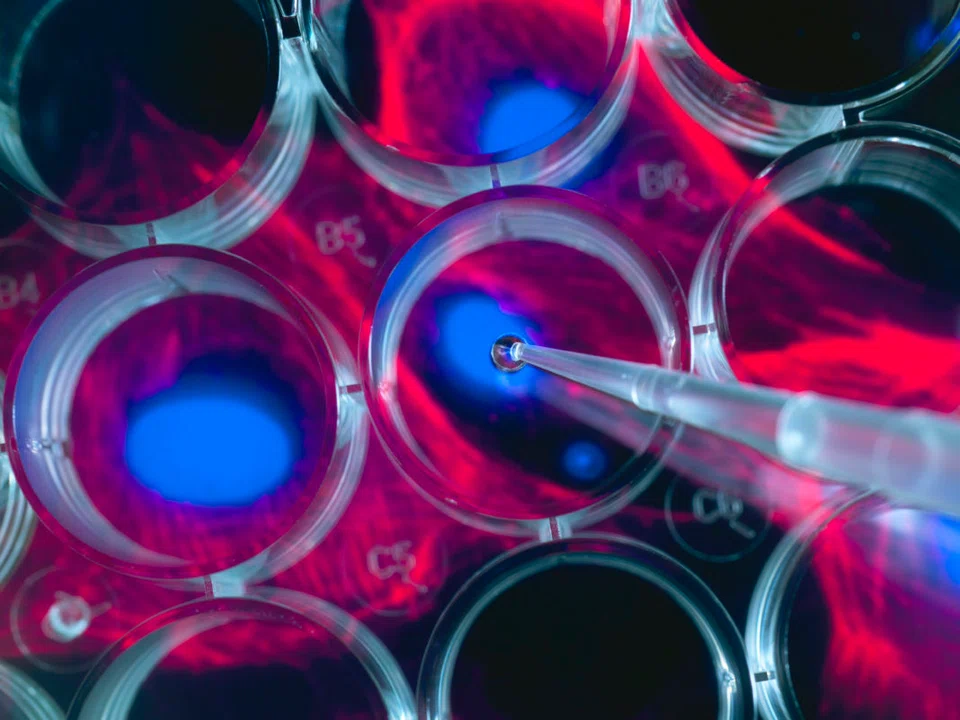 For its latest "N-Nose plus Pancreas" test kit, Hirotsu Bio has tweaked the genetic code of nematodes so that they swim away from pancreatic cancer samples.