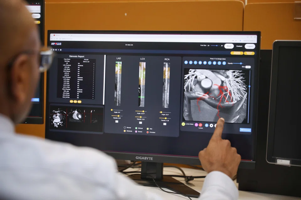 An image from a heart scan at the  National Heart Centre Singapore. In the region, the factors contributing to heart disease are high blood pressure, dietary risks, air pollution, high levels of "bad" cholesterol and smoking.   